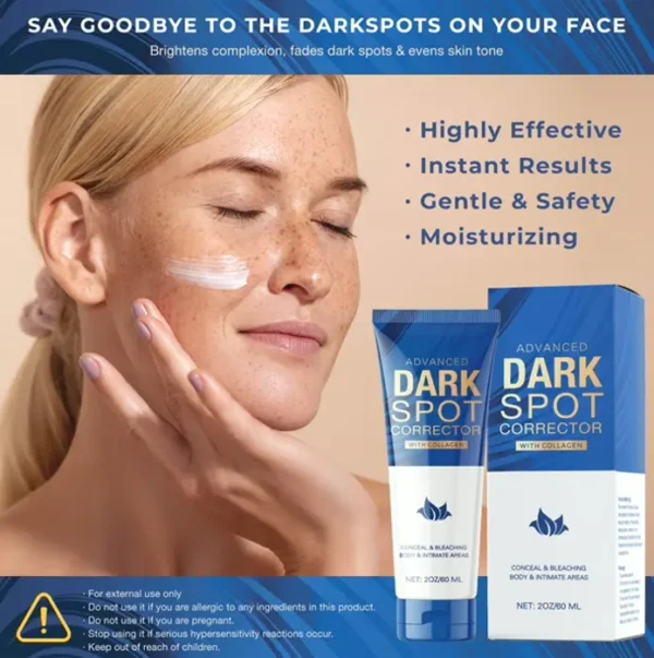 Spot Body: Melasma