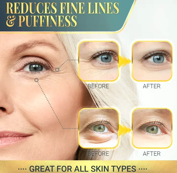 Eye Line Patches with Collagen