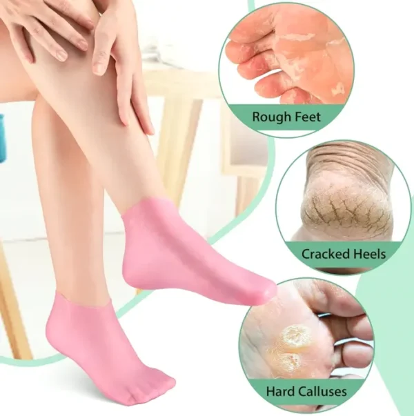 Gel Moisturizing Socks for Cracked Feet - Noverlife