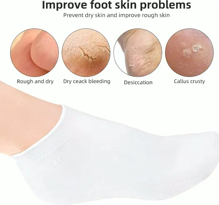 Hydrating Glove & Sock Kit for Dry Hands, Silicone Glove & Socks for Skin Therapy
