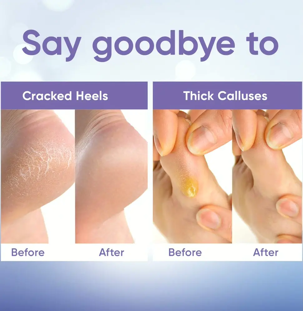 Feet Peel Treatment w/ Aloe Vera