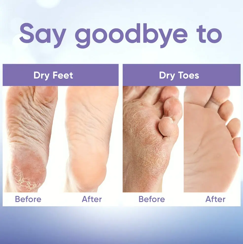 Feet Peel Treatment w/ Aloe Vera