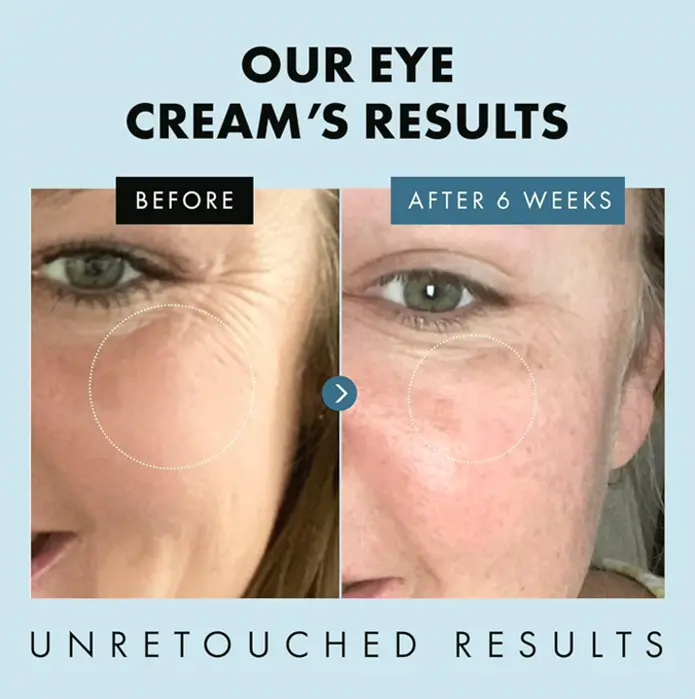 Eye Moisturizer to Minimize Dark Circles and Aging Signs