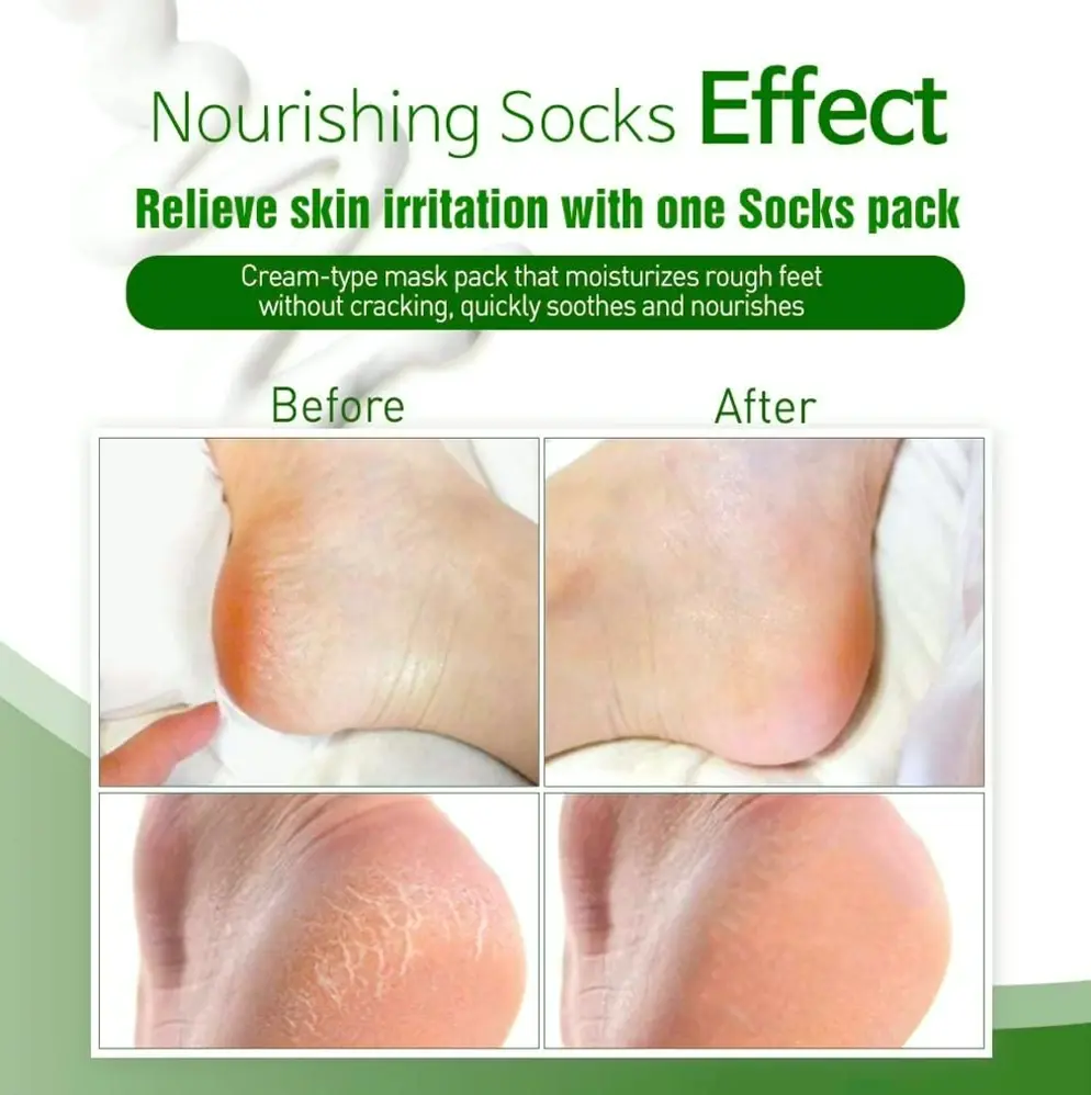 Epielle Nourishing Foot Masks – Herbal Extract