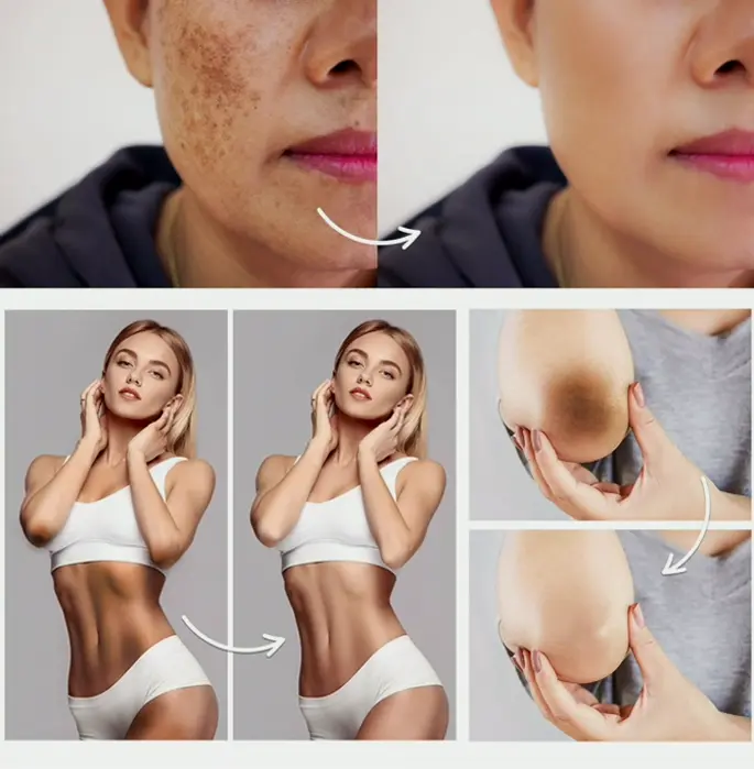 Intimate Body Blemish Lightening - Underarm Treatment for Various Areas