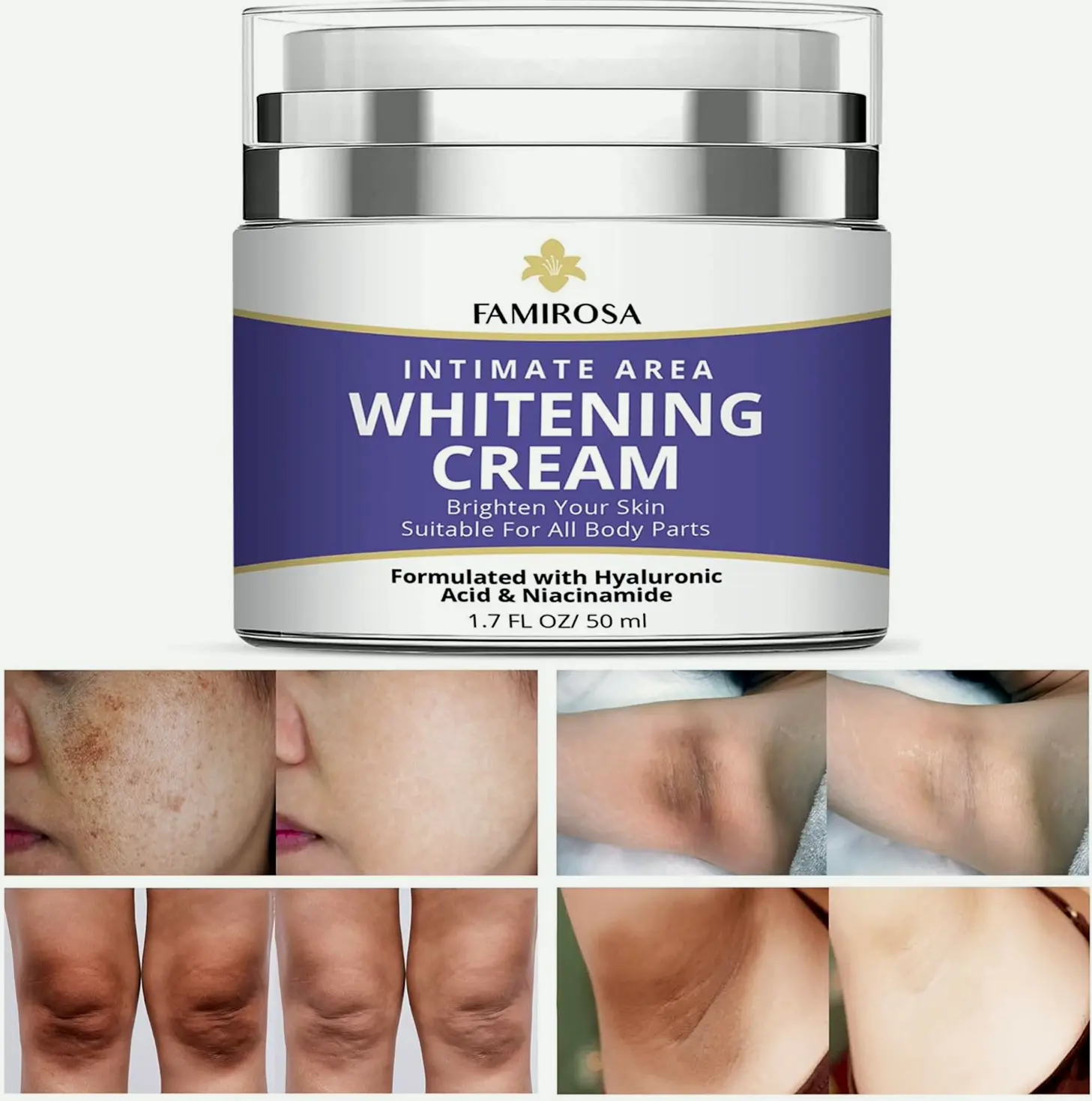 Intimate Body Blemish Lightening - Underarm Treatment for Various Areas