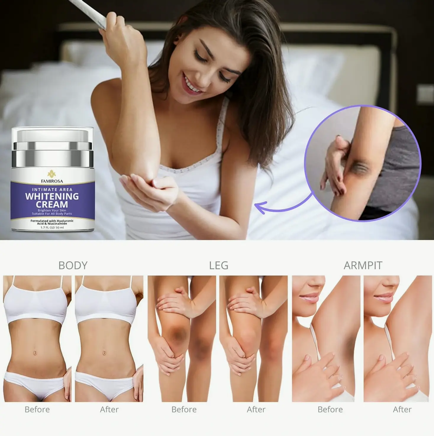 Intimate Body Blemish Lightening - Underarm Treatment for Various Areas