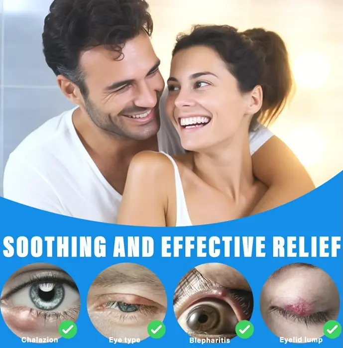 Chalazion Eye Treatment Drops for Quick Efficacy