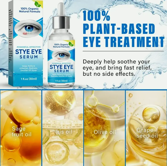 Chalazion Eye Treatment Drops for Quick Efficacy