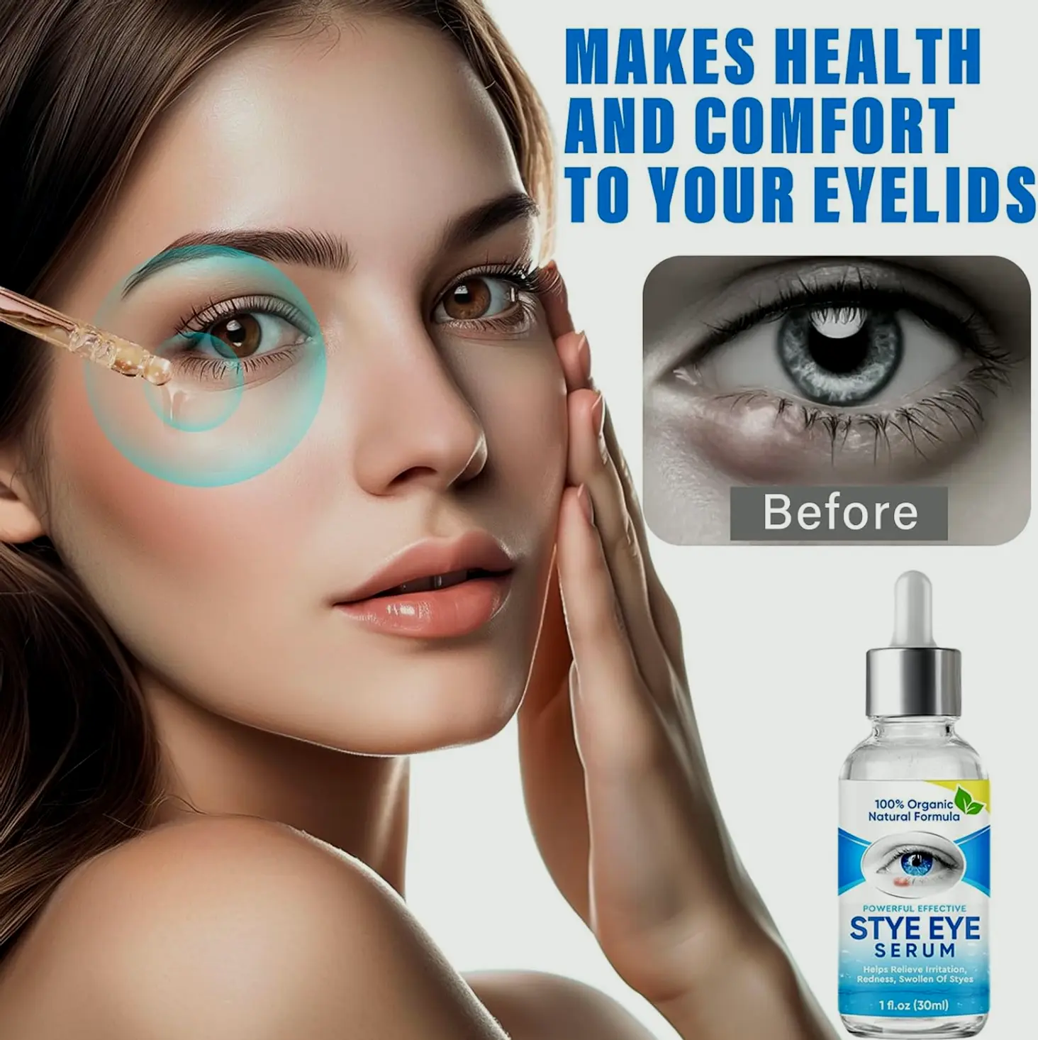 Chalazion Eye Treatment Drops for Quick Efficacy