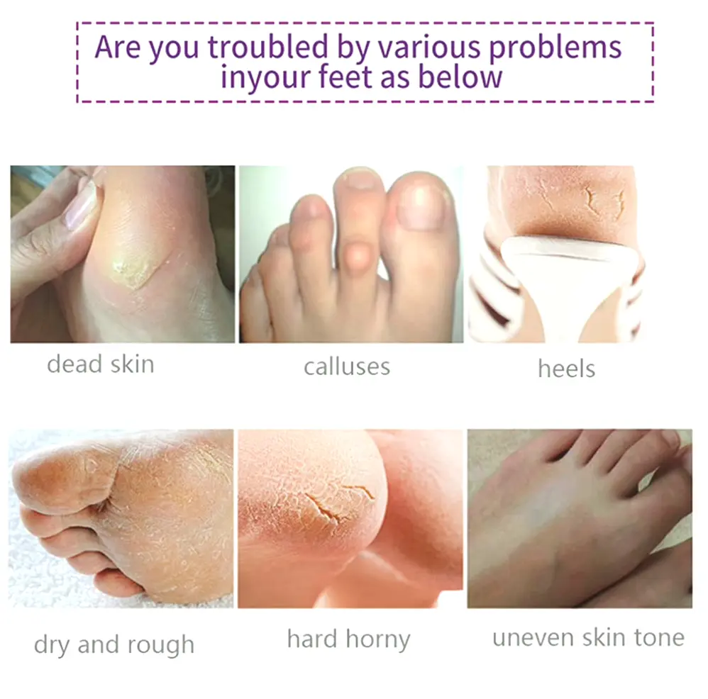 Foot Exfoliating Mask Pack - Smooths Dry Skin